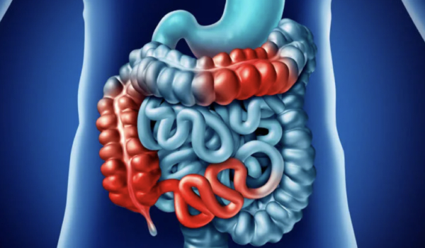 Restitución del Tránsito Intestinal